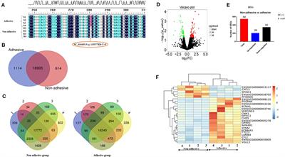 Transcriptomic Study of Porcine Small Intestine Epithelial Cells Reveals Important Genes and Pathways Associated With Susceptibility to Escherichia coli F4ac Diarrhea